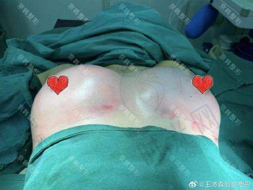 王明利医生技术水平高