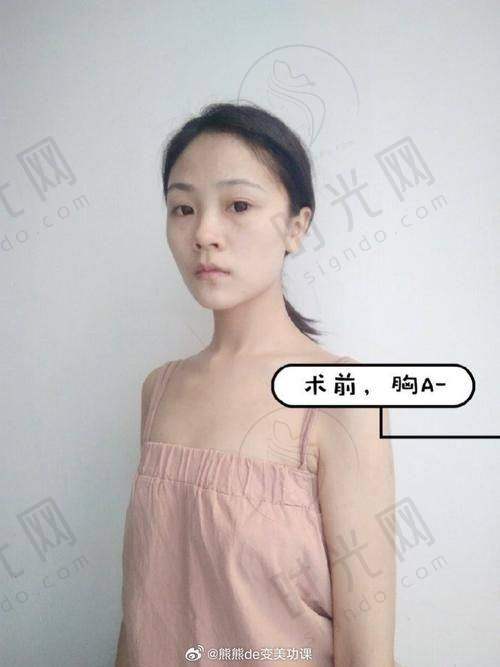 李发成医生预约挂号