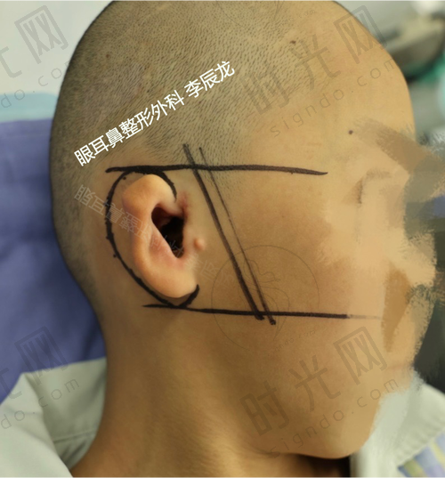 杨庆华医生价格表（2025年全新）