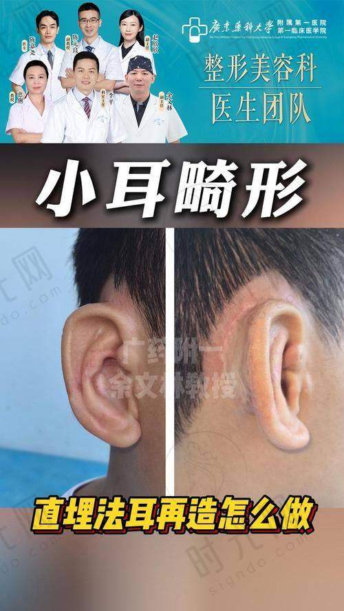 潘博医生预约挂号方式