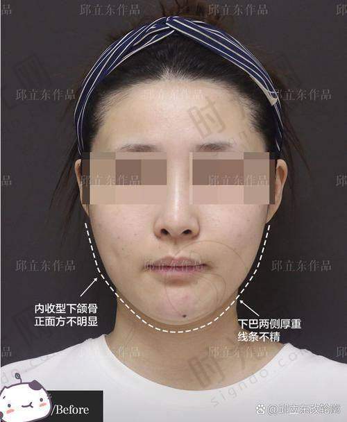 二、张笑天医生擅长项目