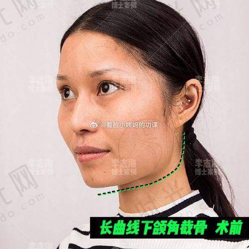 五、张笑天医生坐诊哪个医院？