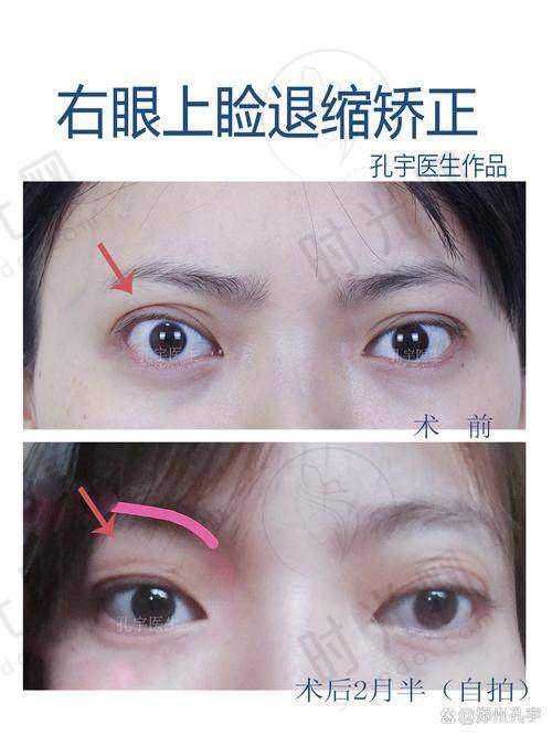 李燕医生擅长项目