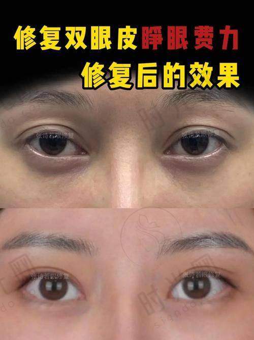 吴焱秋医生价格表（2025年全新）