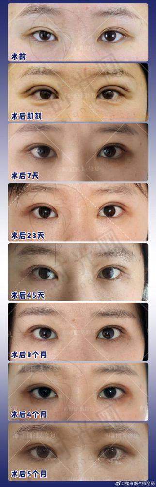 吴焱秋医生预约挂号