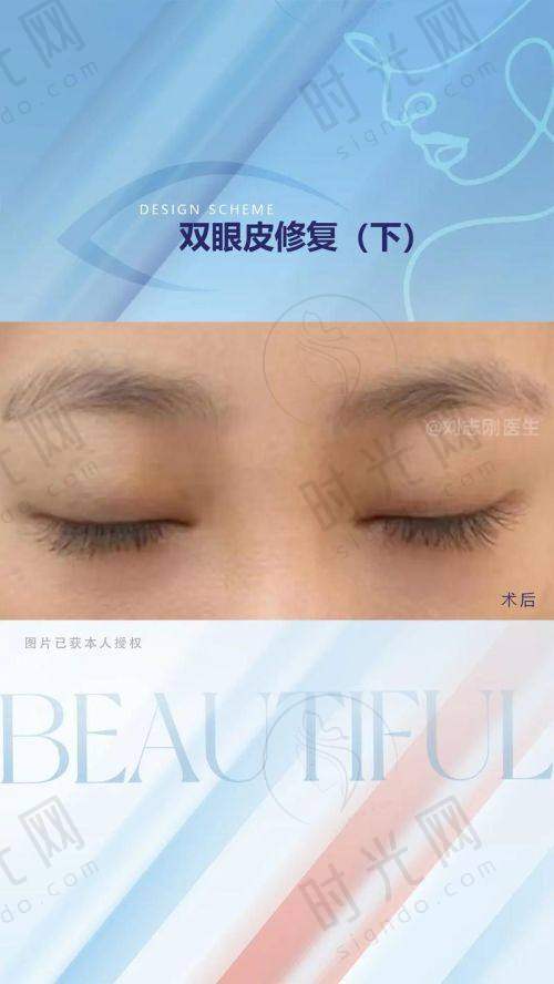 方式3：电话预约