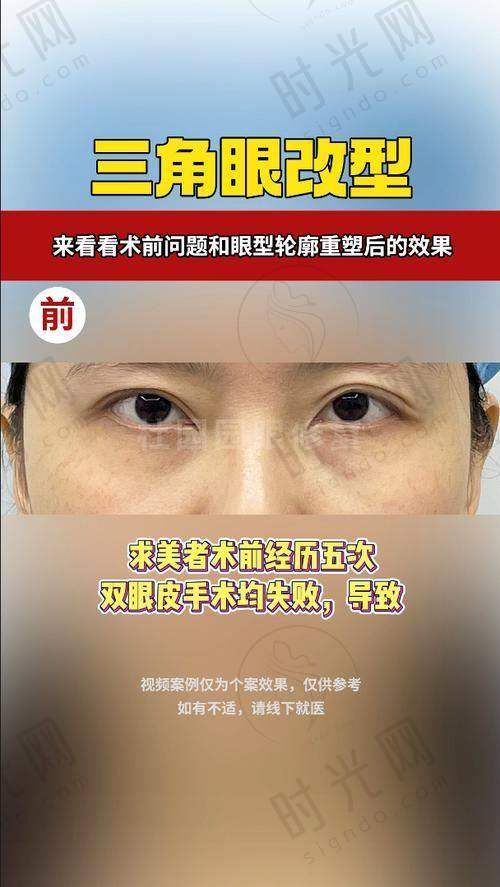 吴焱秋医生擅长项目