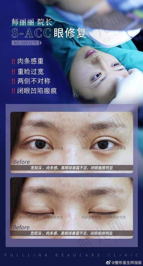 方式2：在线客服预约
