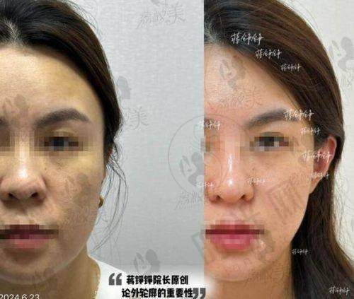 刘蕾医生坐诊哪个医院？