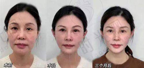 刘蕾医生擅长项目