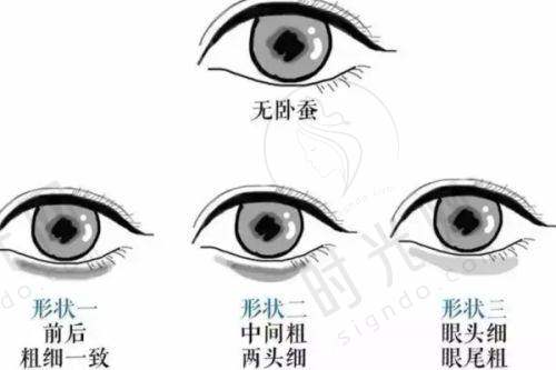 影响骨折手指再造费用的4大关键因素，差一点价格差一半