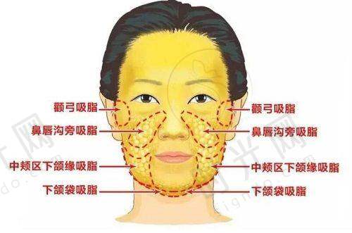 人中加深术十天成效：影响修复速度的四大关键因素
