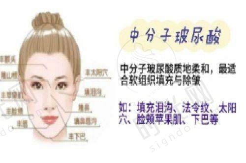 手部骨折拇指翻不过来的保守治疗方案：3招帮你“松绑”拇指