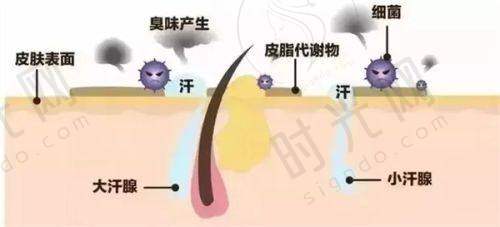 3个在家就能做的矫正动作（附步骤与注意事项）