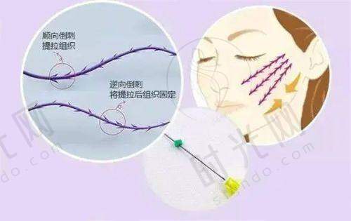 手部骨折拇指翻不过来如何确诊？3步检查指南