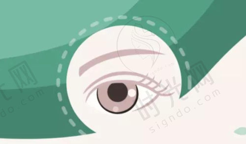 辽宁省白内障免费手术术前术后避坑指南