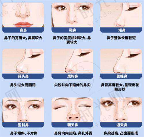 手部骨折拇指翻不去的传统治疗方法：为什么成效往往不理想？