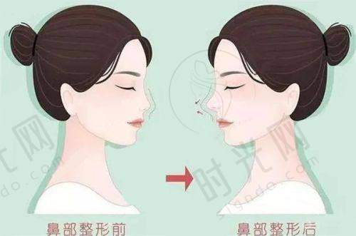 人中加深术十天成效：医生解答修复期十大常见疑问