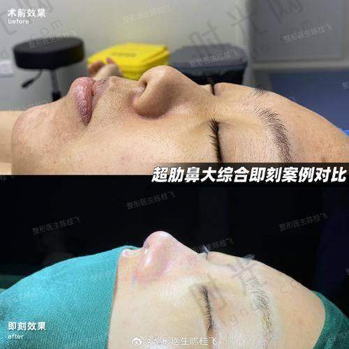 总结
