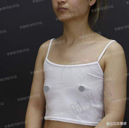 注射丰胸20年了还有风险吗？