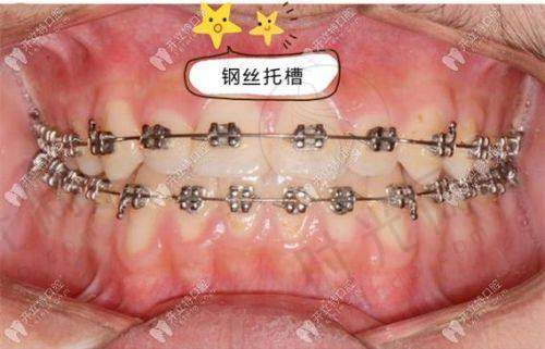 总结：有口腔需求的朋友们选南京鼓楼各口腔医院评价、预约等相关信息的3个核心提醒