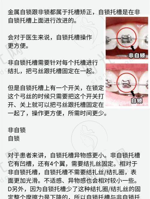 总结：有口腔问题的姐妹选2025麦芽口腔医院地址的3个核心提醒