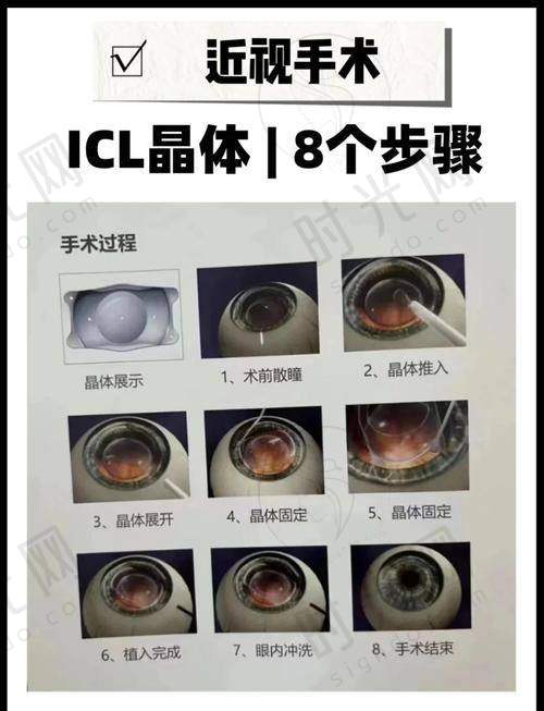天津普瑞眼科医院简介真实实例