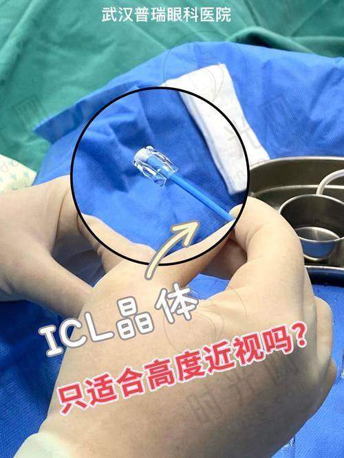 总结:上海黑马眼科医生的温馨提醒