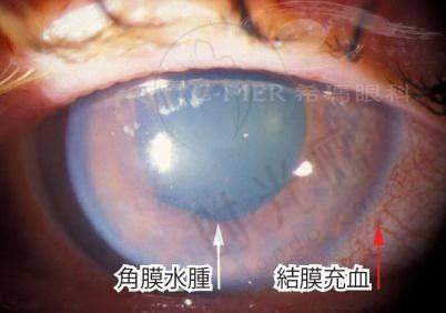 总结:贵阳近视眼科医院排名前五榜单的温馨提醒