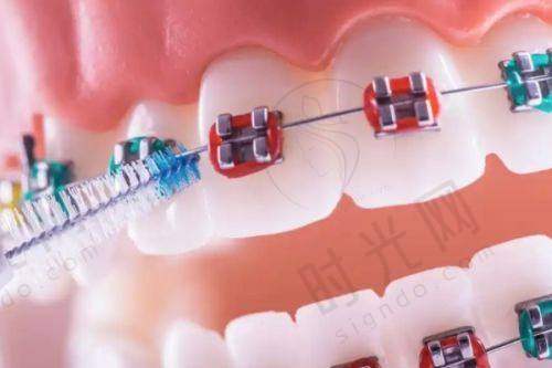 总结:有看牙需求的姐妹选监利县人民医院牙科收费标准,监利中医院牙科价格的3个核心提醒