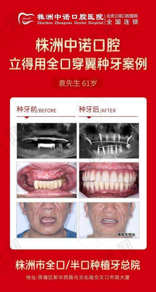 总结:有口腔问题的姐妹选大连齿医生口腔医院的3个核心提醒
