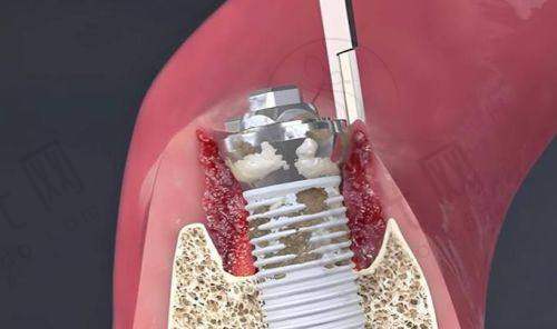 昆明长鹏口腔怎么样?真实实例大揭秘