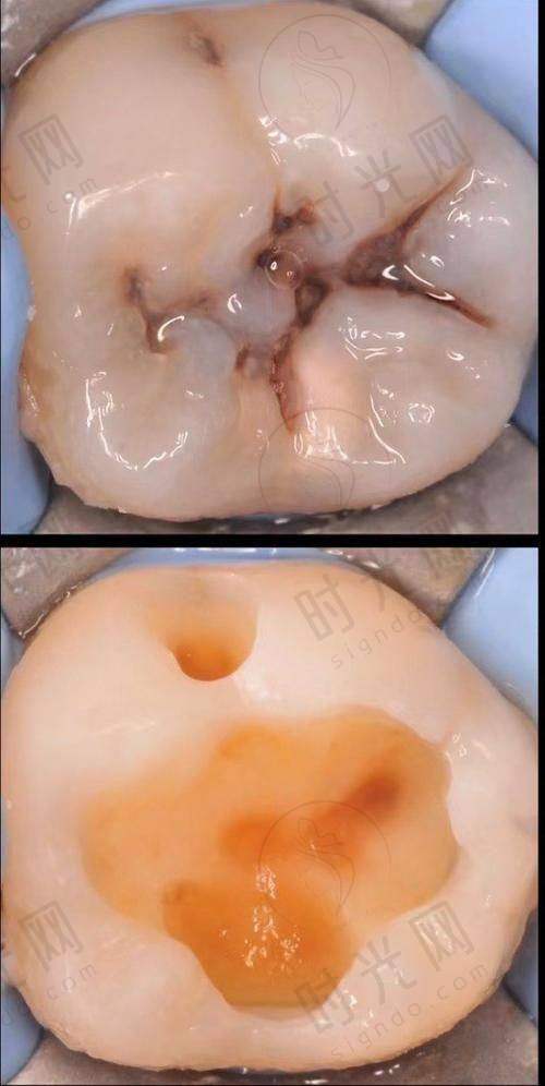 总结:有口腔问题的姐妹选昆明长鹏口腔怎么样的3个核心提醒