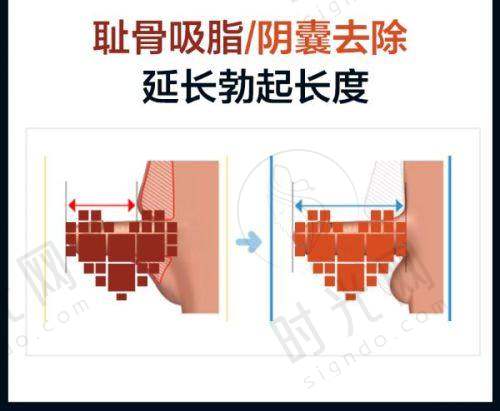 总结