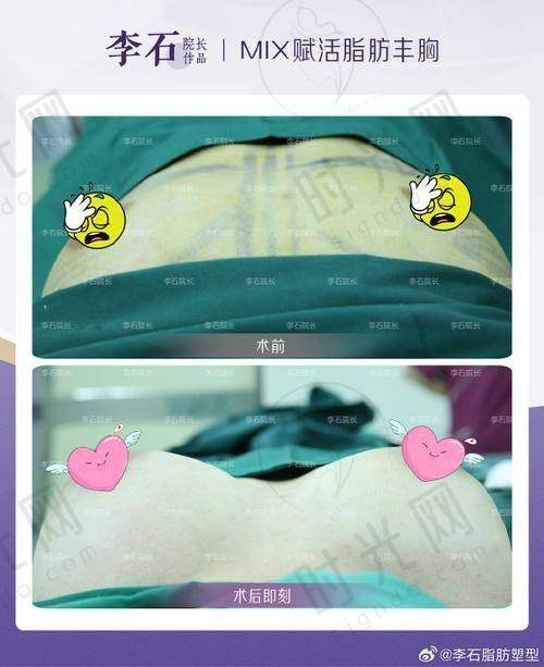 深圳取奥美定的专精医生