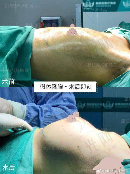 深圳取奥美定的价格表