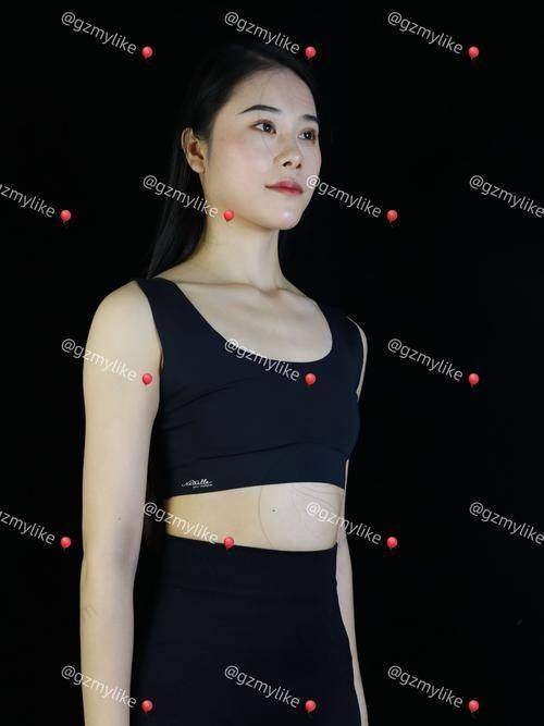 郭震宇自体脂肪丰胸怎么样
