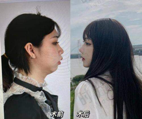 一、合肥半岛超声炮授权机构名单名单