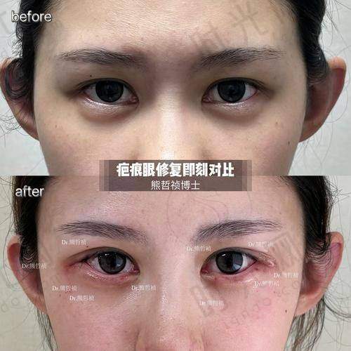 术前术后避坑指南