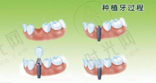 广州海珠区牙科医院实例分享