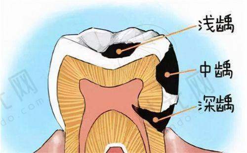大家怎么评价宁波鄞州德中口腔种牙收费标准地址