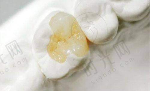 大家怎么评价宁波鄞州德中口腔种牙收费标准价格表