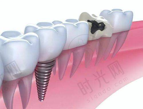 兰州牙科建议去的三个地方实例