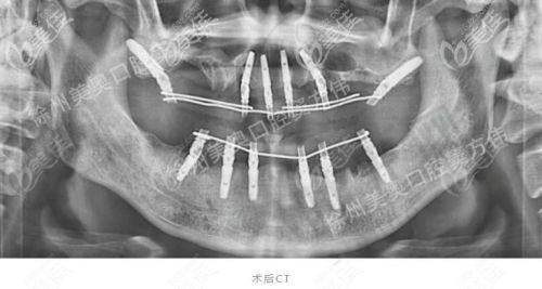 真实实例分享:呼和浩特牙科就诊体验大曝光