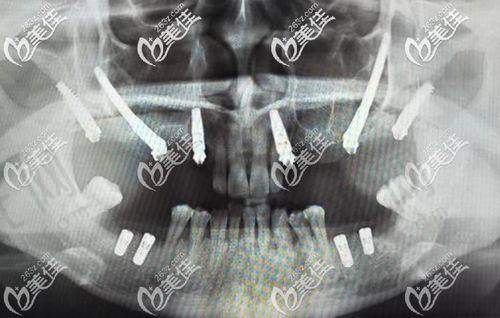 选择呼和浩特牙科的3个重要提醒