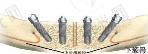 西安性价比高的十大牙科医院选择的3个提醒