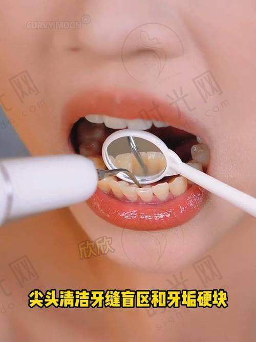 大家怎么评价宁波鄞州德中口腔种牙收费标准医生