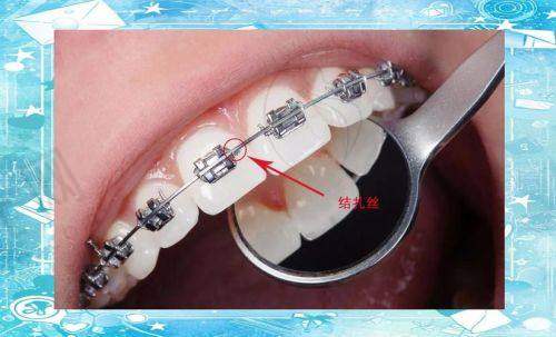 东莞健力口腔医院收费标准诚不欺人电话