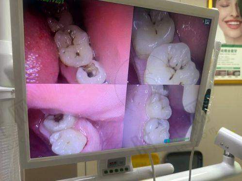上班族种牙选宁波鄞州德中口腔的决策要点