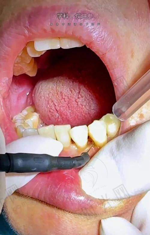 大家怎么评价宁波鄞州德中口腔种牙收费标准怎么样